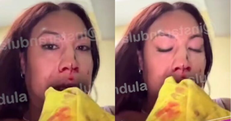 Dayanita sufre accidente vehicular en Huacho y denuncia falta de atención médica: No es posible