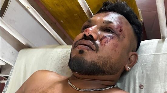 Encuentran a un sobreviviente del accidente aéreo en la India: Había cuerpos a mi alrededor