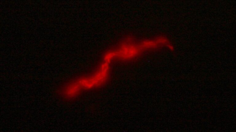 El CONICET desarrolló un método rápido y de bajo costo para el diagnóstico de la tuberculosis