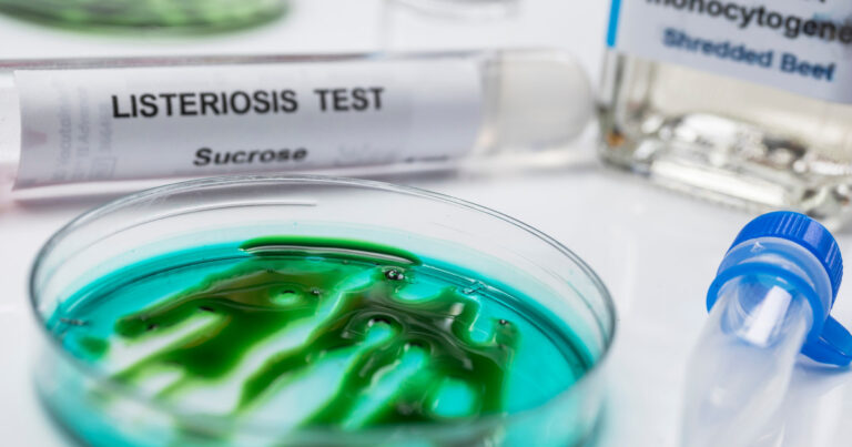 Confirman por primera vez un brote de infecciones potencialmente mortales por el consumo de un queso