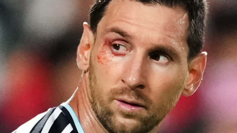 Lionel Messi recibe atención médica en el ojo derecho durante el partido Argentina vs Suiza